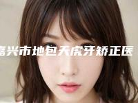嘉兴市地包天虎牙矫正医院在榜名单实力也不错~(嘉兴郑医生口腔居榜首)