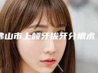 佛山市上颌牙拔牙分根术价格表在线(上颌牙拔牙分根术均价为:322元)