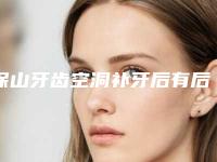 保山牙齿空洞补牙后有后遗症么