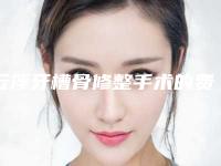 云浮牙槽骨修整手术的费用由那些因素决定