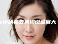 云浮刮痧去黄褐斑难度大吗一般价格多少