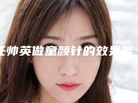 任帅英做童颜针的效果能保持几年
