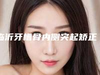 临沂牙槽骨内侧突起矫正手术存在哪些危害