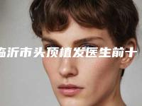 临沂市头顶植发医生前十排行榜权威曝光-陈方医生专业实力优异