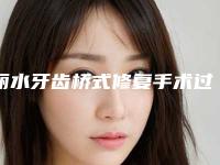 丽水牙齿桥式修复手术过程的风险大吗