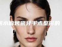 丽水做烤瓷牙手术整形的价格及效果
