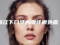 丽江下门牙内侧牙根外露的后遗症有吗