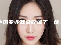 中国专业耳朵咬掉了一块修复医生哪个安全:耳朵咬掉了一块修复医生前50强公立私立五五分