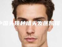 中国头顶种植头发医院排行榜:头顶种植头发医院前50名刷新了