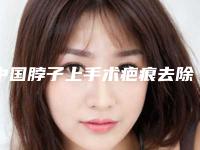 中国脖子上手术疤痕去除医院哪家强：脖子上手术疤痕去除医院前50强榜超全推荐