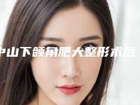 中山下颌角肥大整形术后可能会产生哪些副作用