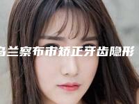 乌兰察布市矫正牙齿隐形托槽上榜清单十强精选排名-乌兰察布市矫正牙齿隐形托槽口腔医生