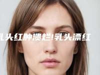 乳头红肿溃烂!乳头漂红整形手术哪家好