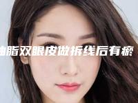 抽脂双眼皮做拆线后有瘀血怎么办 让你追回花季时代的肌肤