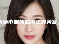 抚顺市自体血清注射美容最好的医院(抚顺矿务局总医院皮肤科医美10强口碑擅长各不同)