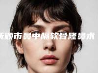 抚顺市鼻中隔软骨隆鼻术好点的医院(辽宁省健康产业集团抚矿总医院一起来瞧瞧实力高低~)