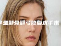 李罡颧骨颧弓修复术手术过程及术后副作用