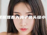摆脱难看大鼻子鼻头缩小要多少钱(把鼻头缩小要多少钱)