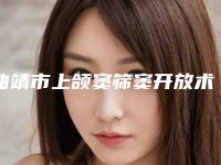 曲靖市上颌窦筛窦开放术口腔医生排行前十位名单换新啦
