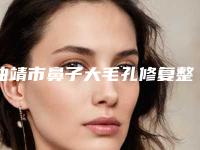 曲靖市鼻子大毛孔修复整型医院-曲靖市第一人民医院医学整形美容科技术不错