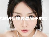 朱灿填充隆鼻基底手术后不满意效果怎么办