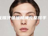 无锡牙缝缝隙填充整形手术比较适合哪种年龄阶段