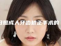 日照成人牙齿矫正手术的价格需要多少