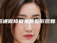 昭通做修复兔唇整形后如何避免后遗症