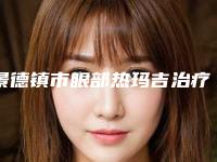 景德镇市眼部热玛吉治疗价格表火爆上线-景德镇市眼部热玛吉治疗术需要价格是多少钱