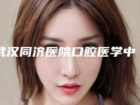 武汉同济医院口腔医学中心怎么样-价格(价目)表2025在线查询