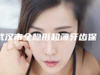 武汉市全隐形超薄牙齿保持器项目价格表(价目)一览-武汉市全隐形超薄牙齿保持器价格