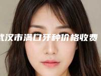 武汉市满口牙种价格收费表升级-武汉市满口牙种价格