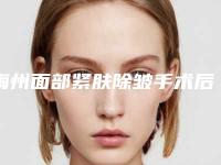 梅州面部紧肤除皱手术后有什么副作用