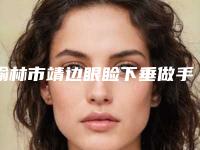 榆林市靖边眼睑下垂做手术排名前十名的医院可供选择