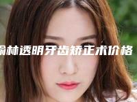榆林透明牙齿矫正术价格不一样