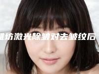 潍坊激光除皱对去皱纹后影响怀孕吗