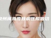 泉州闽海皮肤病医院做切开法双眼皮效果可以维持多上时间