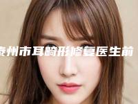 泰州市耳畸形修复医生前十排行榜综合参考-殷小敏医生稳住榜前三