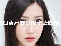 海口市产去除肚子上妊娠纹医生在榜清单前十强汇总-陈燕凌医生你值得选择