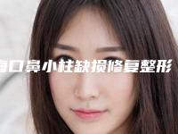 海口鼻小柱缺损修复整形医院哪个好?