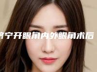 济宁开眼角内外眼角术后副作用有哪些