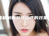 浅龋树脂补牙治疗的效果怎么样