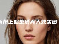 永州上睑整形真人效果图_永州上睑整形术后效果维持多久