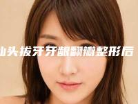 汕头拔牙牙龈翻瓣整形后遗症主要有哪些