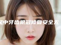 汉中牙齿根冠修复安全无副作用