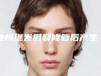 池州继发唇裂修复后产生的副作用有哪些