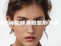 河北省驼峰鼻做整形手术哪家整形医院好-廊坊中月鸿医疗美容门诊部干货总结