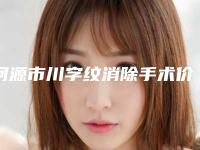 河源市川字纹消除手术价格价位表全新版(川字纹消除手术均价为:4824元)