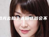 激光去脸上太田痣斑会不会影响身体