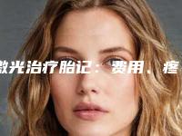 激光治疗胎记:费用、疼痛程度及注意事项全解析